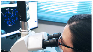 Organoidi di cervello umano nei topi, hanno formato reti neurali