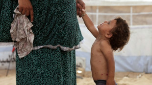 A Gaza, la varicelle de Rouba raconte la vie dans les camps de d&eacute;plac&eacute;s