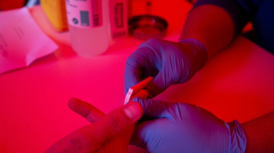 La pr&eacute;carit&eacute;, un moteur de l'&eacute;pid&eacute;mie de VIH en Guyane 