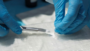 Mann mit hundert P&auml;ckchen Kokain in K&ouml;rper an Flughafen Berlin-Brandenburg erwischt