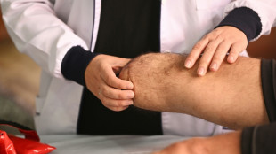 Aumenta el n&uacute;mero de v&iacute;ctimas de minas antipersona en Colombia