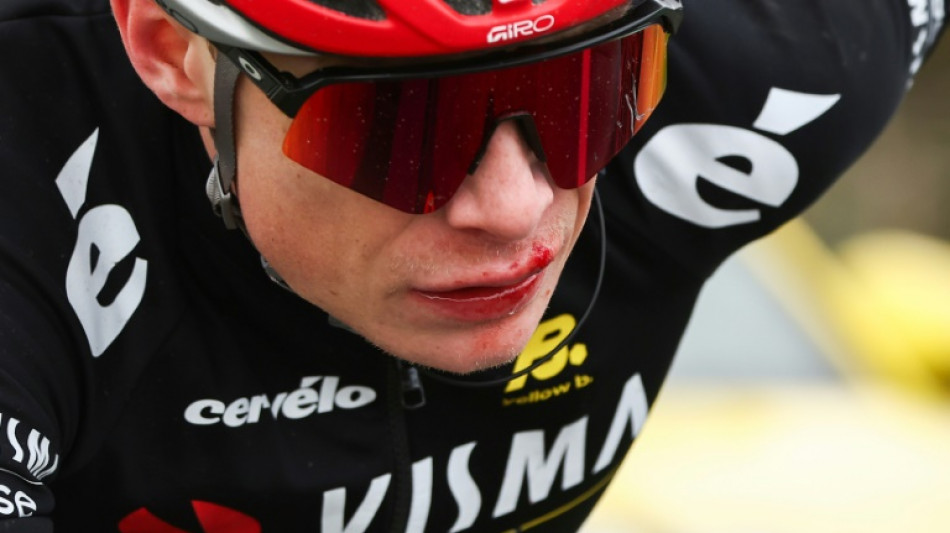 Vingegaard reveals concussion from Paris-Nice fall